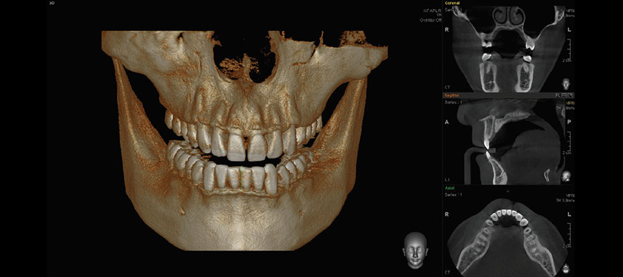 kompyuternaya tomografiya zubov 2