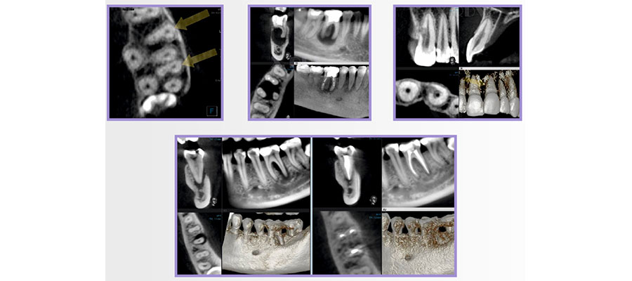 kompyuternaya tomografiya zubov 3