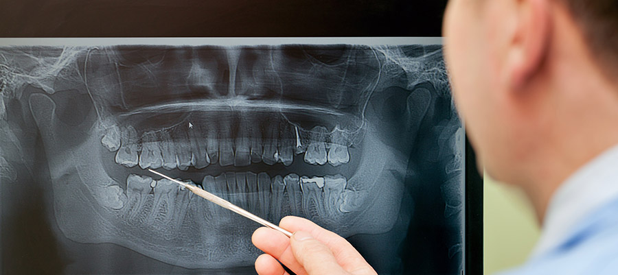 Диагностика в стоматологии с помощью панорамного снимка зубов