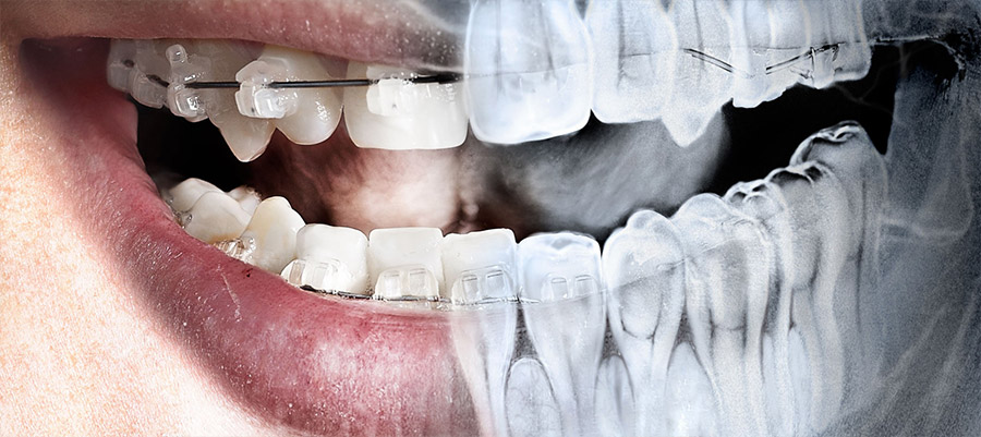 Диагностика зубов и рентген